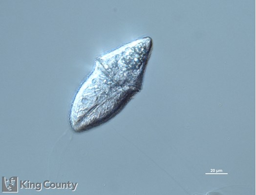Photo of Gymnodinium rubrum
